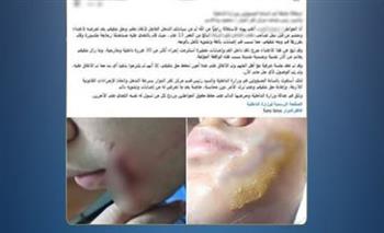   ضبط طالب تعدى على زميله بقطعة زجاج في مشاجرة لهو بالبحيرة