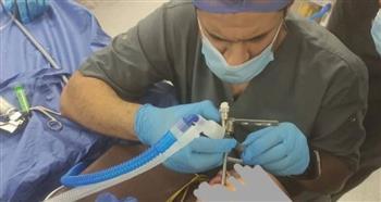 سكين في الرأس.. فريق طبي بمستشفيات جامعة بنها ينقذ حياة طفلة بعملية عاجلة
