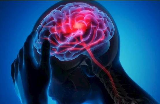 السهر المتكرر قد يهدد صحة الدماغ.. أطباء يحذرون من زيادة خطر السكتات الدماغية