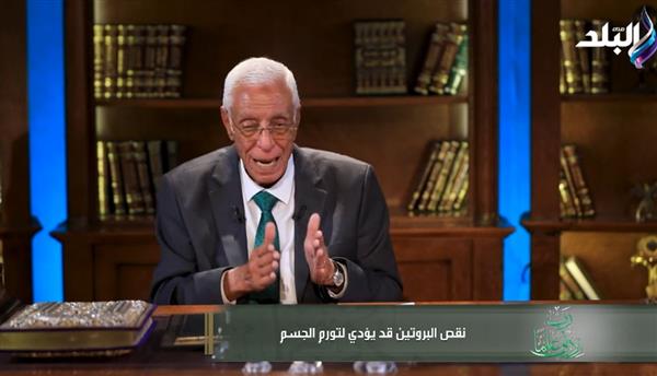حسام موافي يجيب على سيدة تعاني من تورم في الجسم وعدم الاستجابة لأدوية إدرار البول