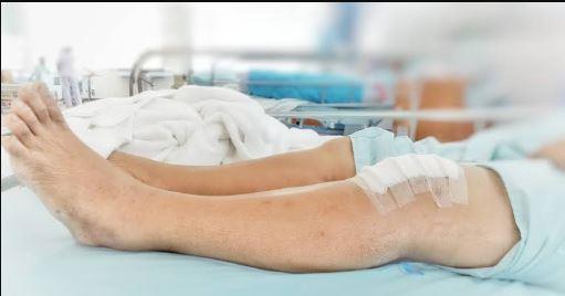 دراسة تكشف مفاجأة بشأن جراحة غضروف الركبة.. متى تصبح ضرورية؟