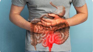 8 أطعمة ومشروبات قد تزيد أعراض القولون العصبي.. تعرف عليها