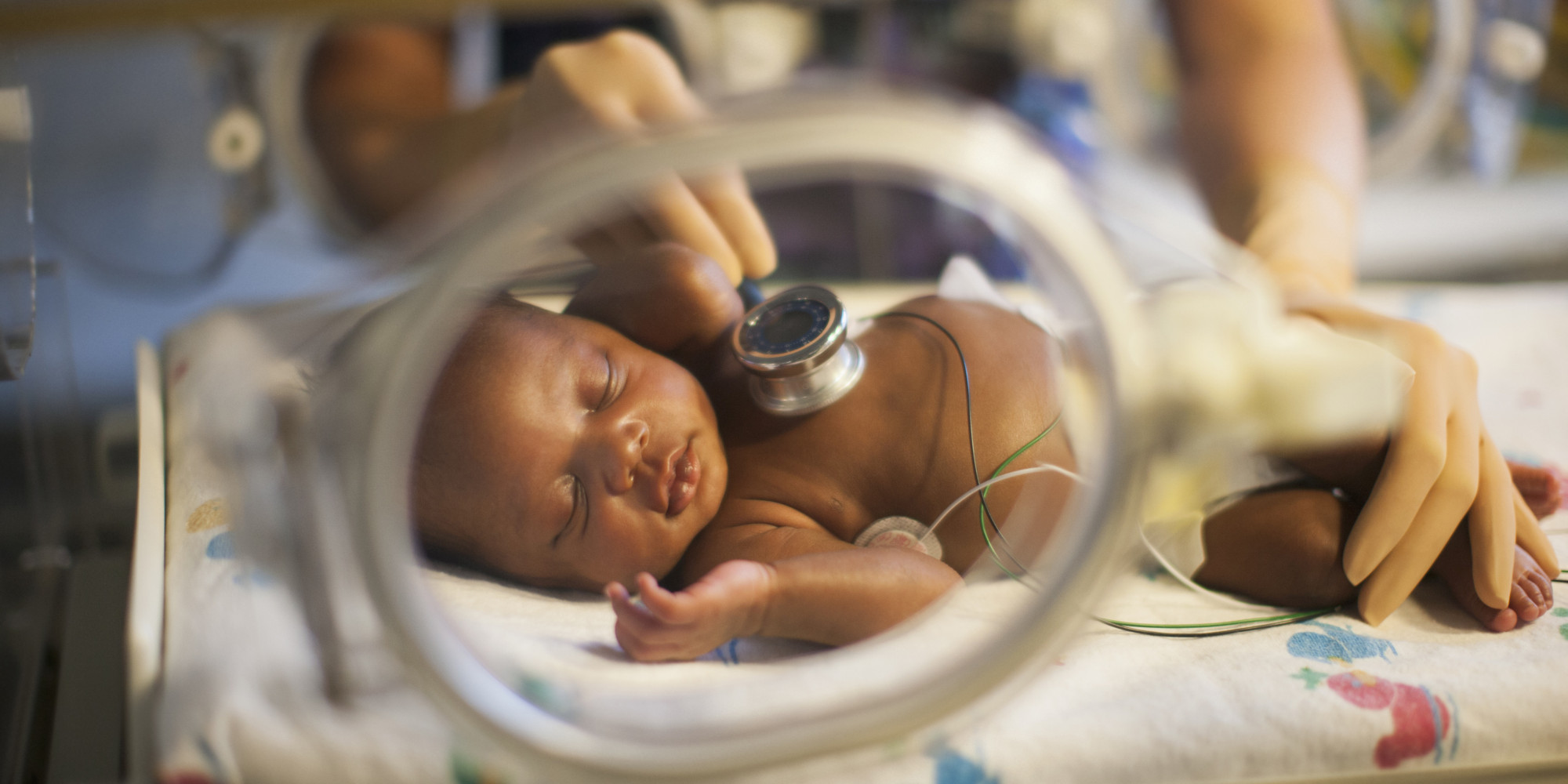   سؤال طبى وإجابته: هل هناك تلازم بين الولادة القيصرية وإصابة الطفل المولود بهذه الطريقة بحساسية الصدر؟!