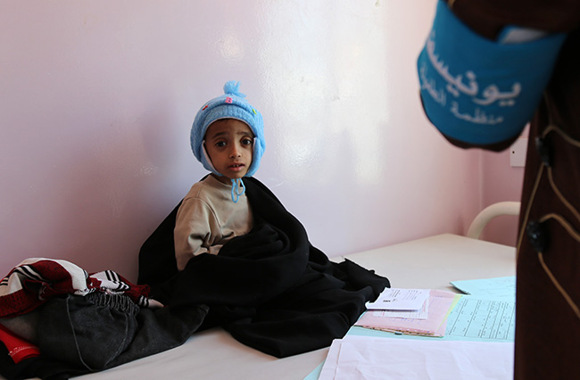   124 ألف حالة اشتباه فى الإصابة بالكوليرا فى اليمن.. نصفهم من الأطفال