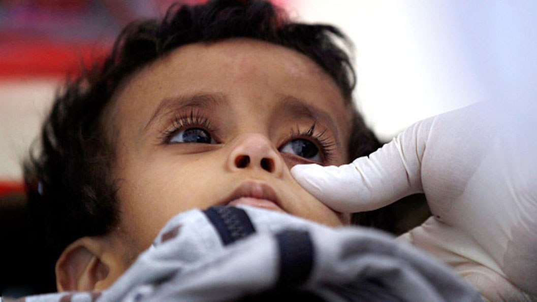   الصليب الأحمر: وفاة 1600 بالكوليرا فى اليمن