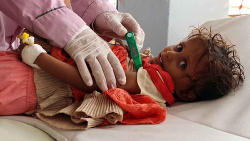   الكوليرا تهدد حياة أكثر من نصف مليون يمنى