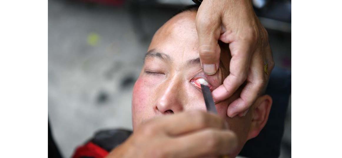   شاهد| حلاق صيني ينظف عيون زبائنه بـ«موس»