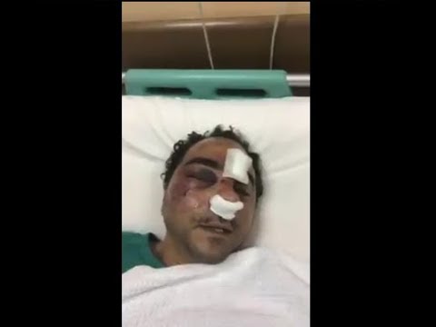   شاهد| الشاب المصرى يحكى تفاصيل الاعتداء عليه فى الكويت.. والسلطات تقبض على أحد المعتدين