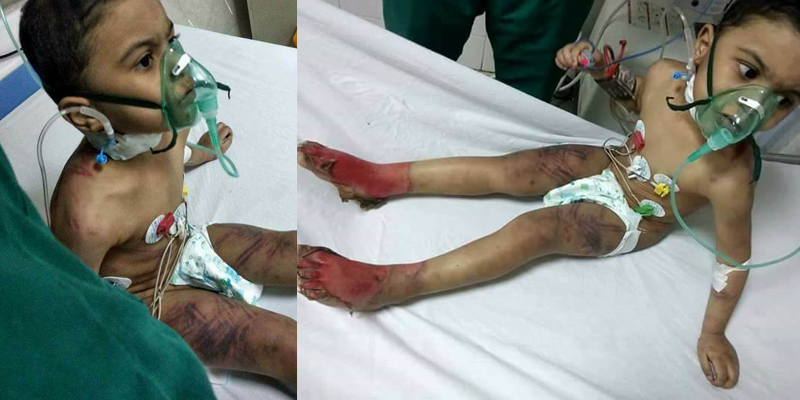   بالصور| القبض على أم عذبت طفلها وحرقته فى كفر الشيخ