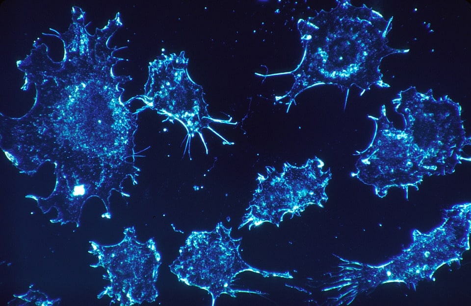   باحثون يطورون علاجًا مناعيًا واعدًا ضد السرطان