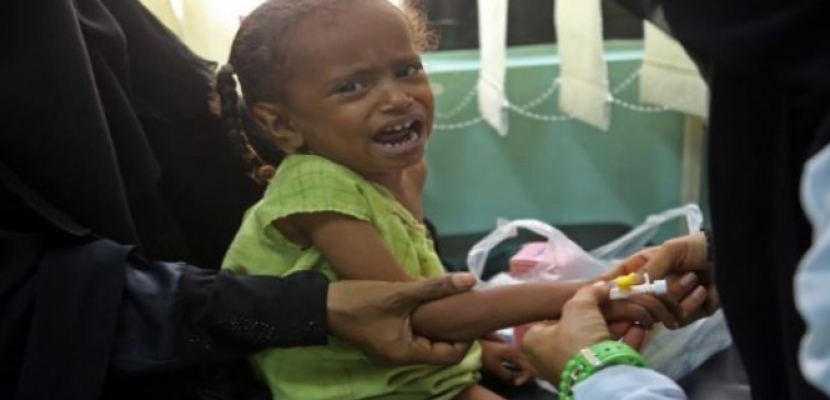   «الجارديان»: معاناة المدنيين في اليمن ليست أسوأ أزمة إنسانية بل جريمة