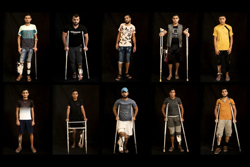   ساقا المتظاهر الغزَّاوى ..هدف تنشين جنود الاحتلال الإسرائيلي