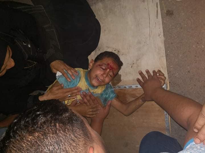   إصابة طفل صدمته دراجة نارية في حادث سير بقرية العنانية بمحافظة دمياط