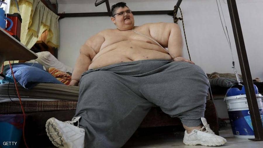 «يفعلها أخيرا» ويمشي مجددا «أسمن» رجل في العالم