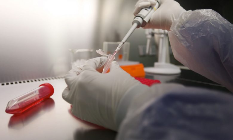   بعد تسجيل أول إصابتين.. الصحة الفرنسية: لا نستبعد تسجيل إصابات أخرى بفيروس كورونا