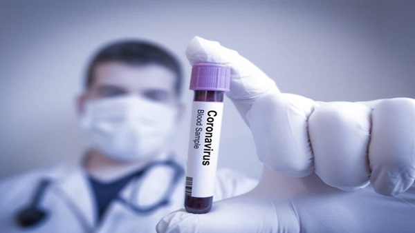   الجزائر تسجل أول حالة وفاة بفيروس كورونا المميت