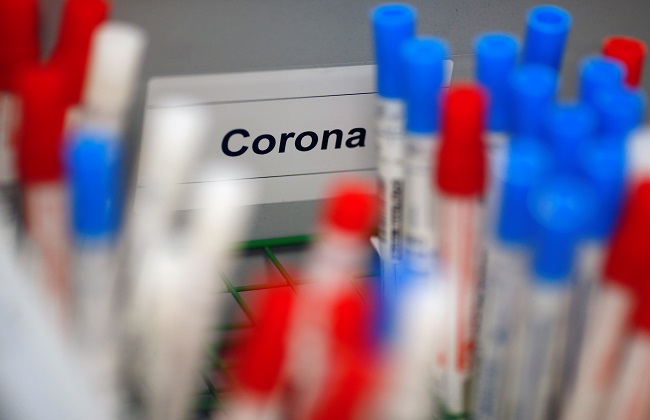    «الصحة» توضح حقيقة تقديم خدمة إجراء تحليل فيروس كورونا بالمنازل