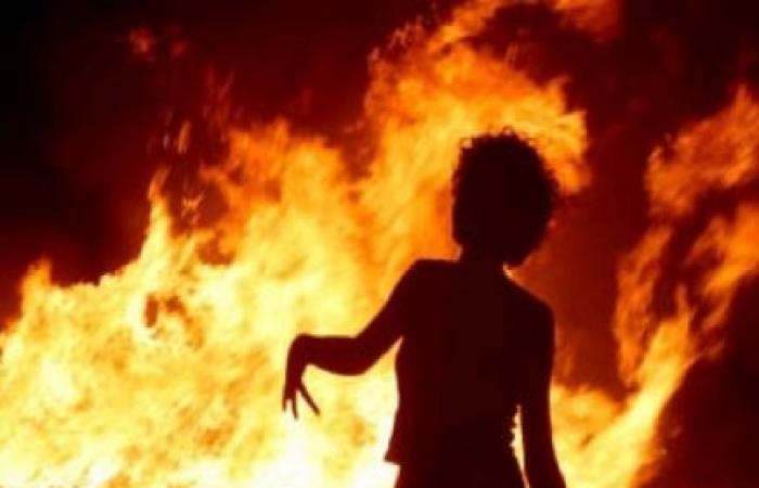   ثلاث شباب يشعلون النيران فى جسد طفل بالمحلة انتقاما من والده