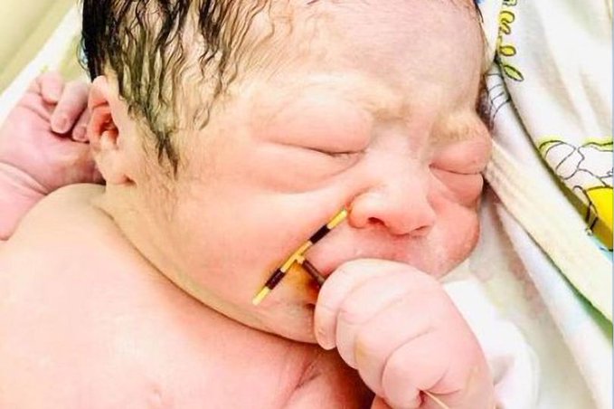   طفل حديث الولادة يحمل «لولب» أمه بين يديه