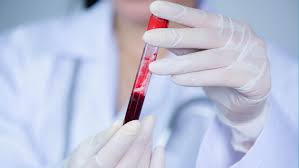   فحص دم يكشف عن أكثر من 50 نوعًا من السرطان بعضها قبل ظهور الأعراض