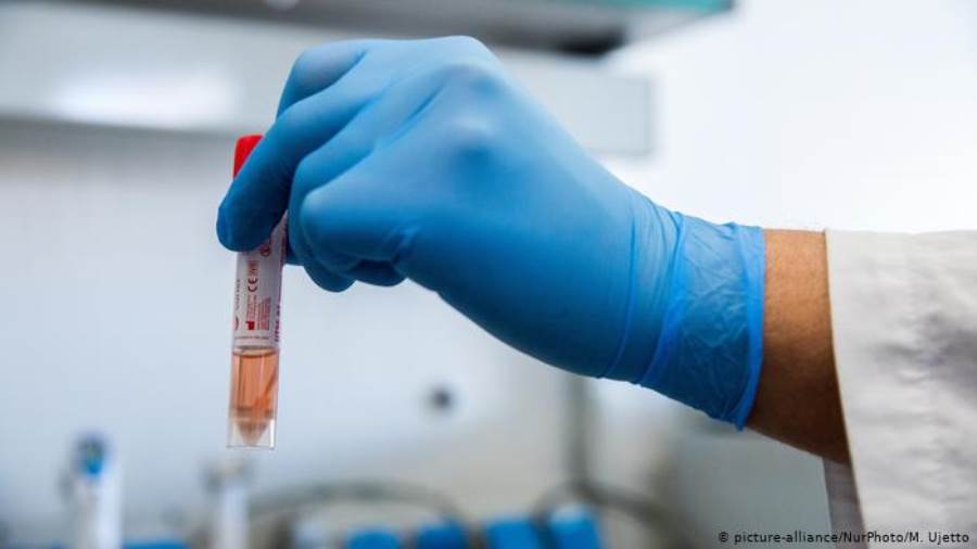   دراسة جديدة تحذر: السلالة الجديدة من فيروس كورونا تزيد من عدد الوفيات