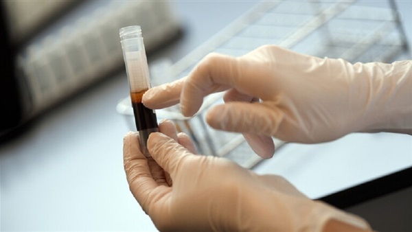   ليبيا تسجل 824 حالة إصابة جديدة بفيروس كورونا