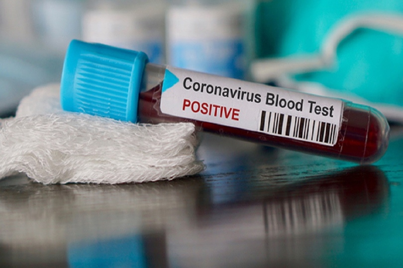   الصحة: تسجيل 358 حالة إيجابية جديدة لفيروس كورونا